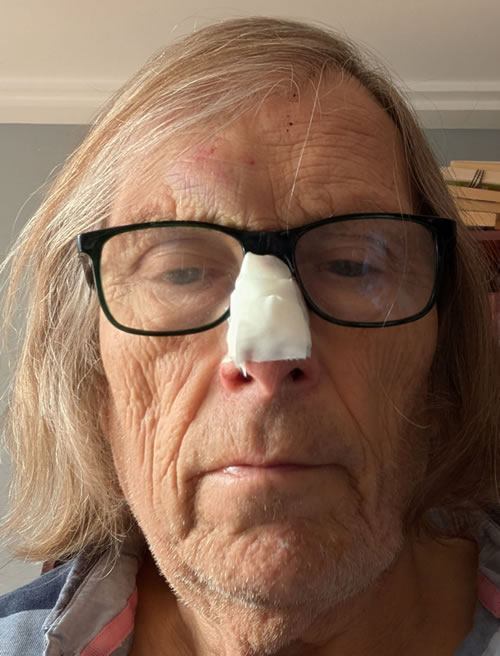 Guy nose dressing 